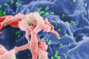 기사로 이동 - 3년째 줄었는데…작년 HIV 감염 아동 1명, 99%는 ‘이 경로’였다
