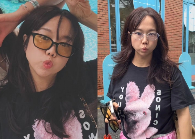 thumbnail - 홍현희, 약 없이 11kg 뺐더니…성형 의혹 부른 턱선