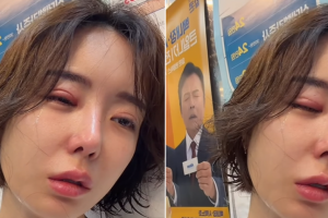 기사로 이동 - “눈 뒤집더니 터트렸다” 이소라, 1000만원 성형보다 아픈 근황