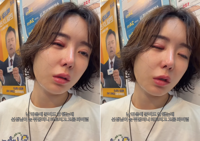 thumbnail - “눈 뒤집더니 터트렸다” 이소라, 1000만원 성형보다 아픈 근황