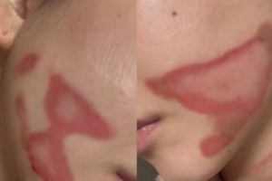 기사로 이동 - “턱선이 왜 저래” 의료사고 겪은 권민아, 수척해진 근황에 걱정
