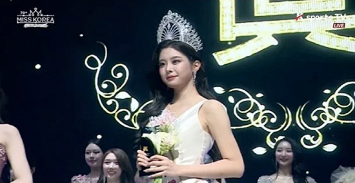 thumbnail - “성형은 안 했고 시술만” 미코 진 고백에…논란 터진 진짜 이유