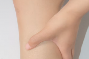 기사로 이동 - ‘다리가 왜 이러지?’ 무심코 넘긴 그 저림, 종아리 혈관의 경고였다