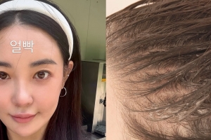 기사로 이동 - “비어 보여서 흑채 뿌려요”… 39살 걸그룹 출신 여배우의 탈모 고민