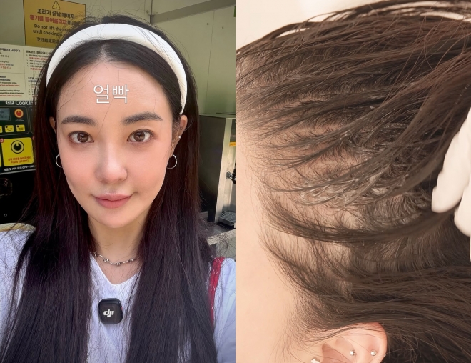 thumbnail - “비어 보여서 흑채 뿌려요”… 39살 걸그룹 출신 여배우의 탈모 고민